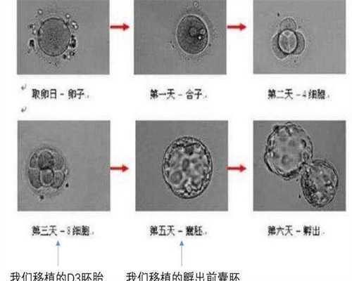 试管三代