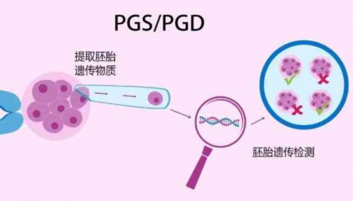 人工授精