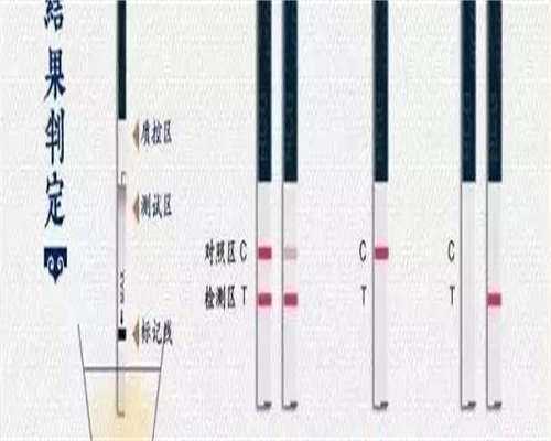 子宫内膜息肉不孕